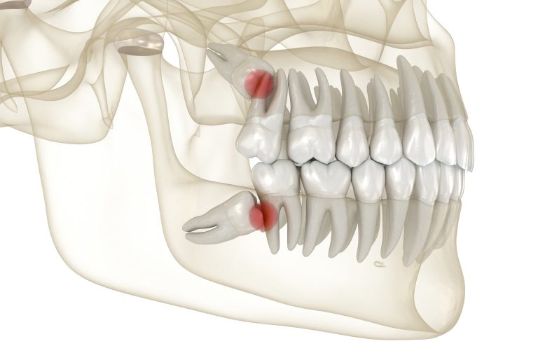 Cirugía Oral