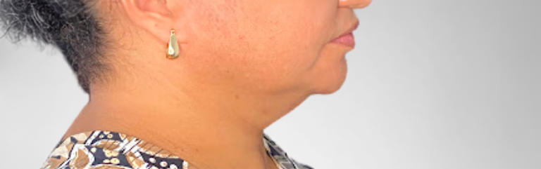 Lipopapada